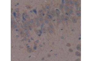 IHC-P analysis of Rat Tissue, with DAB staining. (DPP4 antibody  (AA 638-767))