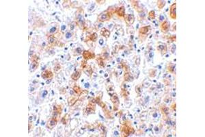 Immunohistochemistry of SCO2 in human liver tissue with SCO2 polyclonal antibody  at 2.