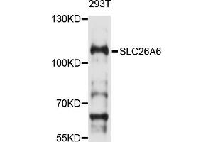 Western blot analysis of extracts of 293T cells, using SLC26A6 antibody (ABIN4905190) at 1:1000 dilution. (SLC26A6 antibody)