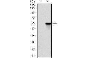 Western blot analysis using ROCK1 mAb against HEK293 (1) and ROCK1 (AA: 403-610)-hIgGFc transfected HEK293 (2) cell lysate. (ROCK1 antibody)