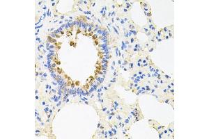 Immunohistochemistry of paraffin-embedded rat lung using NCR3 antibody (ABIN5974302) at dilution of 1/100 (40x lens). (NCR3 antibody)