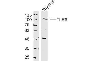 Mouse thymus lysates probed with TLR6 Polyclonal Antibody, unconjugated  at 1:300 overnight at 4°C followed by a conjugated secondary antibody at 1:10000 for 90 minutes at 37°C. (TLR6 antibody  (AA 301-400))