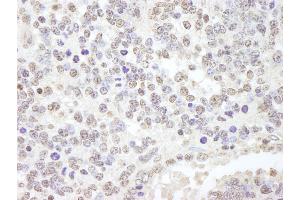 Immunohistochemistry (IHC) image for anti-Ubiquitin Specific Peptidase 47 (USP47) (C-Term) antibody (ABIN7449031)