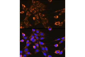 Immunofluorescence analysis of NIH-3T3 cells using Integrin-β1/CD29 Rabbit pAb (ABIN6134032, ABIN6142578, ABIN6142579 and ABIN6219452) at dilution of 1:100 (40x lens). (ITGB1 antibody  (AA 600-700))