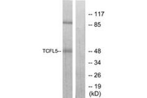Western blot analysis of extracts from RAW264. (TCFL5 antibody  (AA 311-360))