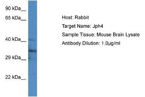 Host: Rabbit Target Name: Jph4 Sample Type: Mouse Brain lysates Antibody Dilution: 1. (Junctophilin 4 antibody  (Middle Region))