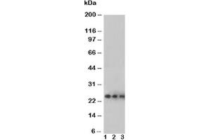 Western blot testing of VEGF antibody and Lane 1:  Recombinant human protein 10ng;  2: 5ng;  3: 2.