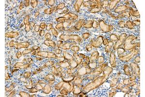 ABIN6265698 and ABIN6277586 at 1/100 staining Rat kidney tissue by IHC-P.