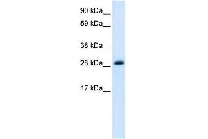Human heart; WB Suggested Anti-ABT1 Antibody Titration: 1. (Activator of Basal Transcription 1 antibody  (Middle Region))
