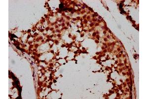IHC image of ABIN7152883 diluted at 1:500 and staining in paraffin-embedded human testis tissue performed on a Leica BondTM system.