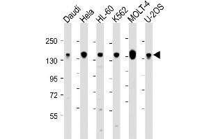 Western Blot at 1:2000 dilution Lane 1: Daudi whole cell lysate Lane 2: Hela whole cell lysate Lane 3: HL-60 whole cell lysate Lane 4: K562 whole cell lysate Lane 5: MOLT-4 whole cell lysate Lane 6: U-2OS whole cell lysate Lysates/proteins at 20 ug per lane. (THRAP3 antibody  (C-Term))