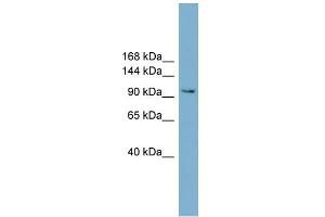 WB Suggested Anti-NCAM2 Antibody Titration:  0. (NCAM2 antibody  (Middle Region))