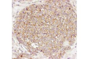 Immunohistochemistry. (AKT1 antibody  (C-Term))
