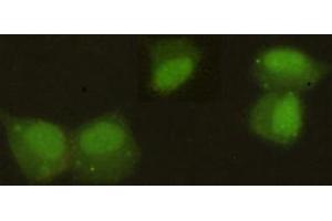 Immunocytochemistry stain of Hela using HP1 alpha mouse mAb (1:300). (CBX5 antibody)