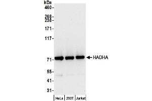 Western Blotting (WB) image for anti-Hydroxyacyl-Coenzyme A Dehydrogenase/3-Ketoacyl-Coenzyme A Thiolase/enoyl-Coenzyme A Hydratase (Trifunctional Protein), alpha Subunit (HADHA) (AA 713-763) antibody (ABIN7450311)