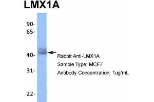 Host: Rabbit  Target Name: LMX1A  Sample Tissue: MCF7  Antibody Dilution: 1. (LMX1A antibody  (Middle Region))