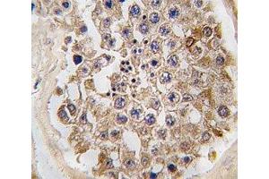 IHC analysis of FFPE human testis tissue stained with mTOR antibody (MTOR antibody  (AA 2459-2488))
