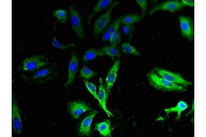 Immunofluorescent analysis of Hela cells using ABIN7171536 at dilution of 1:100 and Alexa Fluor 488-congugated AffiniPure Goat Anti-Rabbit IgG(H+L) (TAS2R13 antibody  (AA 150-184))