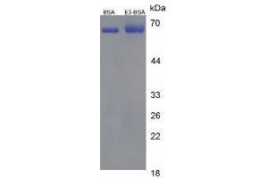 Image no. 1 for Estriol (E3) protein (BSA) (ABIN1880184) (Estriol (E3) Protein (BSA))