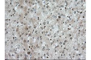 Image no. 4 for anti-Transforming, Acidic Coiled-Coil Containing Protein 3 (TACC3) antibody (ABIN1498096)