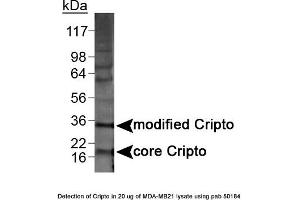 Image no. 1 for anti-Teratocarcinoma-Derived Growth Factor 1 (TDGF1) (N-Term) antibody (ABIN363493) (TDGF1 antibody  (N-Term))