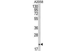 Western blot analysis of FTH1 Antibody (C-term) in A2058 cell line lysates (35 µg/lane).