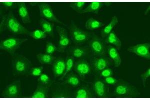 Immunofluorescence analysis of A549 cells using LIG1 Polyclonal Antibody (LIG1 antibody)