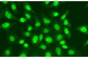 Immunofluorescence analysis of A549 cells using LIG1 Polyclonal Antibody (LIG1 antibody)