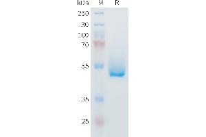 Mouse IL6 Protein, hFc Tag on SDS-PAGE under reducing condition. (IL-6 Protein (AA 25-211) (Fc Tag))
