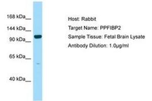 Image no. 1 for anti-Liprin-beta-2 (PPFIBP2) (AA 760-809) antibody (ABIN6750129)