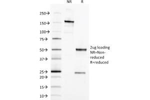 SDS-PAGE (SDS) image for anti-Epithelial Cell Adhesion Molecule (EPCAM) (AA 77-202), (Extracellular Domain) antibody (ABIN6939978)