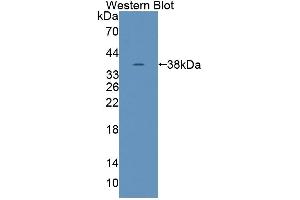 Detection of Recombinant TNS1, Human using Polyclonal Antibody to Tensin 1 (TNS1) (Tensin 1 antibody  (AA 4-307))