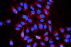 IHC analysis of Cyclophilin B using anti-Cyclophilin B antibody (ABIN6719475).