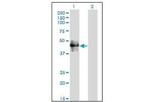 Western Blotting (WB) image for anti-CD177 Molecule (CD177) antibody (ABIN781918) (CD177 antibody)