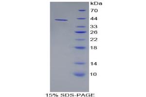 SDS-PAGE analysis of Human AMY1 Protein. (Alpha-amylase 1 Protein)