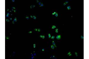 Immunofluorescence staining of Hela cells with ABIN7139968 at 1:100, counter-stained with DAPI. (OR1K1 antibody  (AA 261-273))