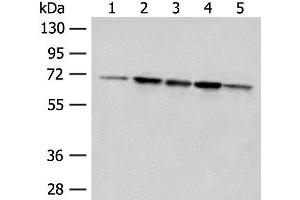 Western blot analysis of 293T cell Rat liver tissue A172 and Jurkat cell lysates using ACSF2 Polyclonal Antibody at dilution of 1:400