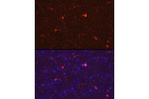 Immunofluorescence analysis of rat brain cells using /IB Rabbit pAb (2391) at dilution of 1:50 (40x lens). (Iba1 antibody  (AA 1-147))