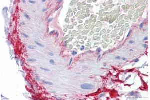 Human Vessel: Formalin-Fixed, Paraffin-Embedded (FFPE) (ROCK2 antibody  (AA 1279-1389))