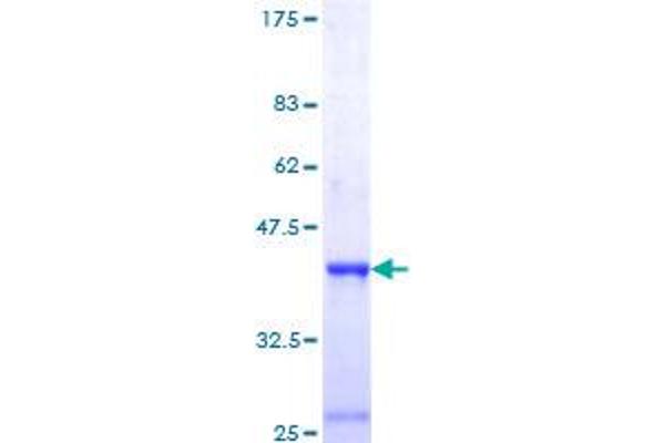 HMGB2 Protein (AA 91-187) (GST tag)