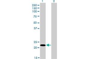 Western Blotting (WB) image for anti-serine/arginine-Rich Splicing Factor 10 (SRSF10) (AA 1-100) antibody (ABIN564697)