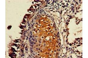 Immunohistochemistry of paraffin-embedded human lung tissue using ABIN7162445 at dilution of 1:100 (P2RX4 antibody  (AA 91-176))