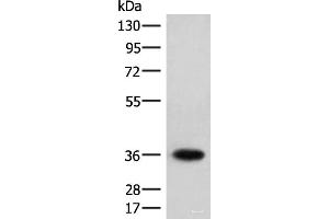 Western blot analysis of Jurkat cell lysate using HOXC12 Polyclonal Antibody at dilution of 1:500