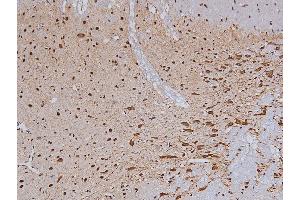 ABIN6267324 at 1/200 staining Rat brain tissue sections by IHC-P. (Tyrosine Hydroxylase antibody  (pSer19))
