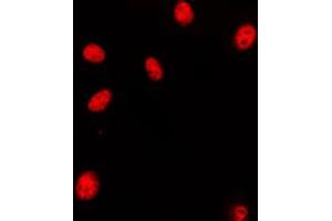 Immunofluorescent analysis of HOXA11/D11 staining in HeLa cells. (HOXA11/D11 antibody  (C-Term))
