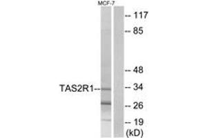 Western Blotting (WB) image for anti-Taste Receptor, Type 2, Member 1 (TAS2R1) (AA 6-55) antibody (ABIN2891095) (TAS2R1 antibody  (AA 6-55))