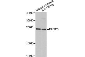 Western blot analysis of extracts of various cell lines, using DUSP3 antibody (ABIN6290308) at 1:3000 dilution.