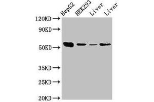 Western Blot Positive WB detected in: HepG2 whole cell lysate, HEK293 whole cell lysate, Rat liver tissue, Mouse liver tissue All lanes: MAP2K5 antibody at 3. (MAP2K5 antibody  (AA 1-190))