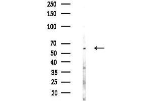 anti-Atlastin GTPase 3 (ATL3) (C-Term) antibody