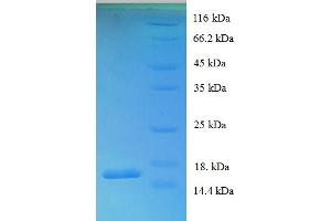 SDS-PAGE (SDS) image for Diazepam Binding Inhibitor (DBI) (AA 2-105) protein (His tag) (ABIN5709385)